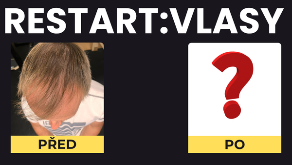 Projekt RESTART: VLASY – Start👨🦲